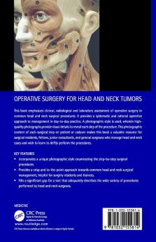 Operative Surgery for Head and Neck Tumors