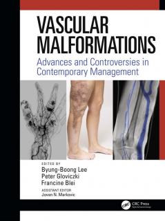 Vascular Malformations