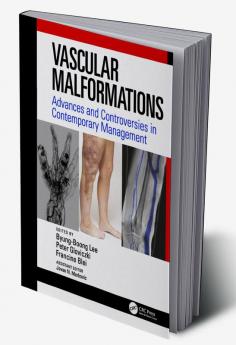 Vascular Malformations