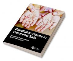 Paediatric Cases in Coloured Skin