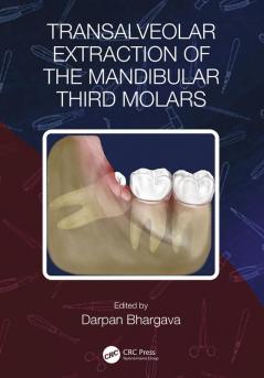 Transalveolar Extraction of the Mandibular Third Molars