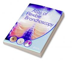 Atlas of Flexible Bronchoscopy