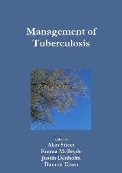 Management of Tuberculosis