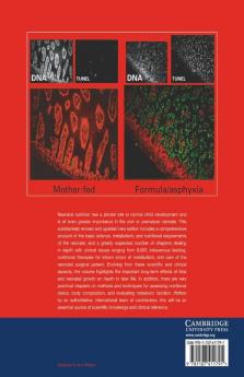 Neonatal Nutrition and Metabolism