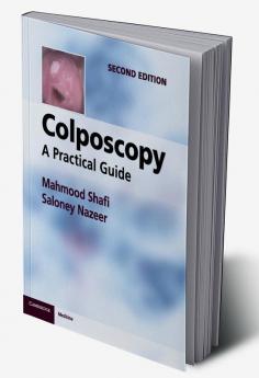 Colposcopy