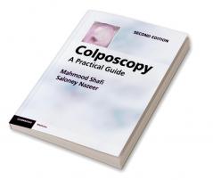 Colposcopy