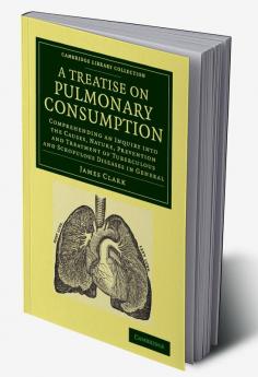 A   Treatise on Pulmonary Consumption