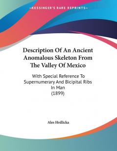 Description Of An Ancient Anomalous Skeleton From The Valley Of Mexico