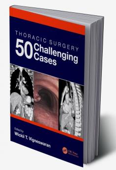 Thoracic Surgery: 50 Challenging cases