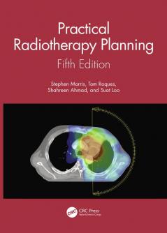 Practical Radiotherapy Planning