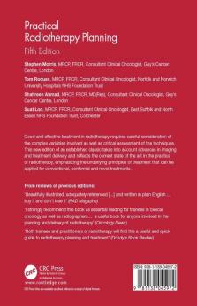 Practical Radiotherapy Planning