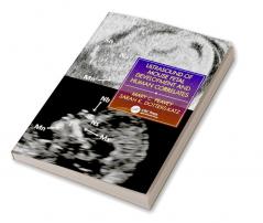 Ultrasound of Mouse Fetal Development and Human Correlates