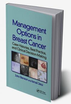 Management Options in Breast Cancer