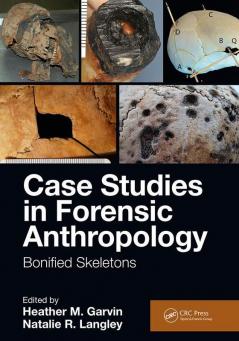 Case Studies in Forensic Anthropology