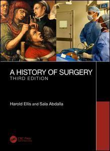 History of Surgery