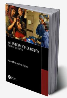 History of Surgery