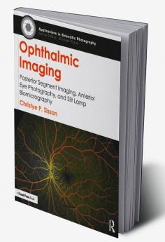 Ophthalmic Imaging