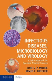Infectious Diseases Microbiology and Virology
