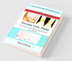 Eczema Cure Today - Get rid of Eczema forever natural ways to cure Eczema
