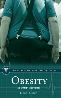 Obesity 2nd Edition (Health and Medical Issues Today)