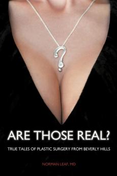 Are Those Real?: True Tales of Plastic Surgery from Beverly Hills