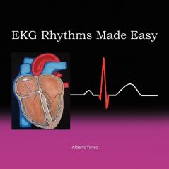 EKG Rhythms Made Easy