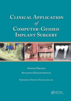 CLINICAL APPLICATION OF COMPUTER-GUIDED IMPLANT SURGERY