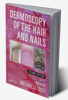 Dermoscopy of the Hair and Nails