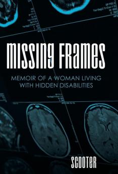 Missing Frames