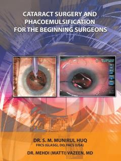 Cataract Surgery And Phacoemulsification For The Beginning Surgeons