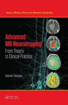 Advanced MR Neuroimaging