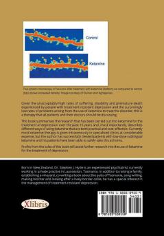 Ketamine for Depression