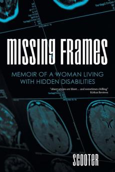 Missing Frames