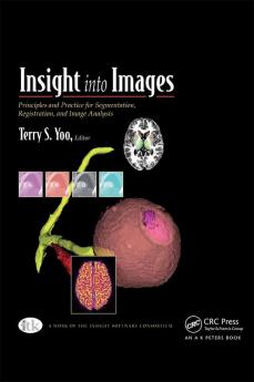 Insight into Images