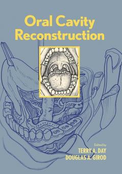 Oral Cavity Reconstruction