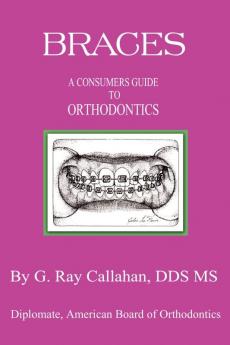 Braces: A Consumers Guide to Orthodontics