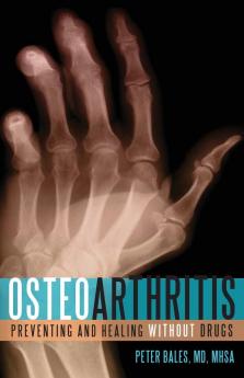 Osteoarthritis