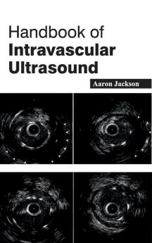 Handbook of Intravascular Ultrasound