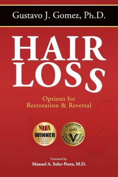Hair Loss Second Edition