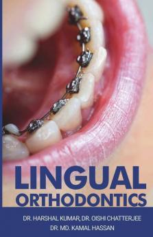 Lingual Orthodontics
