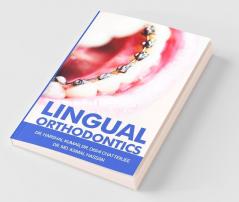 Lingual Orthodontics