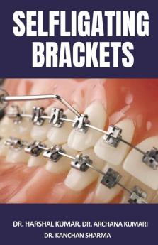 Selfligating Brackets