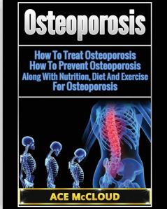 Osteoporosis: How To Treat Osteoporosis: How To Prevent Osteoporosis: Along With Nutrition Diet And Exercise For Osteoporosis (Reverse or Prevent Bone Loss from Osteoporosis All)