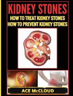 Kidney Stones: How To Treat Kidney Stones: How To Prevent Kidney Stones (Kidney Stone Treatment & Prevention Guide with All)