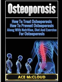 Osteoporosis: How To Treat Osteoporosis: How To Prevent Osteoporosis: Along With Nutrition Diet And Exercise For Osteoporosis (Reverse or Prevent Bone Loss from Osteoporosis All)