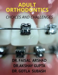 Adult Orthodontics : Choices And Challenges