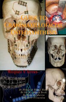 Guide To Craniomaxillofacial Osteosynthesis: Mini Plate And Screw