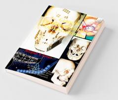 Guide To Craniomaxillofacial Osteosynthesis: Mini Plate And Screw