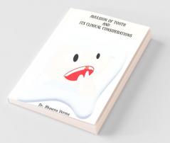 Avulsion Of Tooth And Its Clinical Considerations: Dental Traumatic Injuries