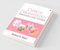 Clinical Dermatology Through Case Studies